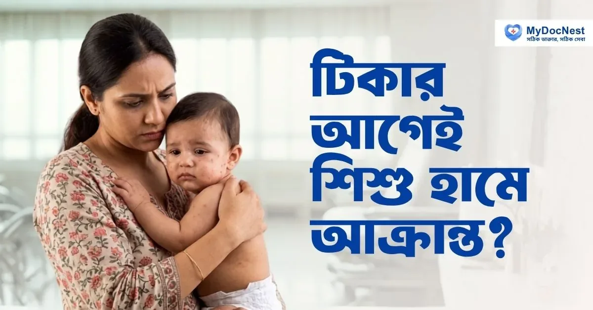 Worried mother caring for a sick infant next to overlay text about infant measles before vaccination
